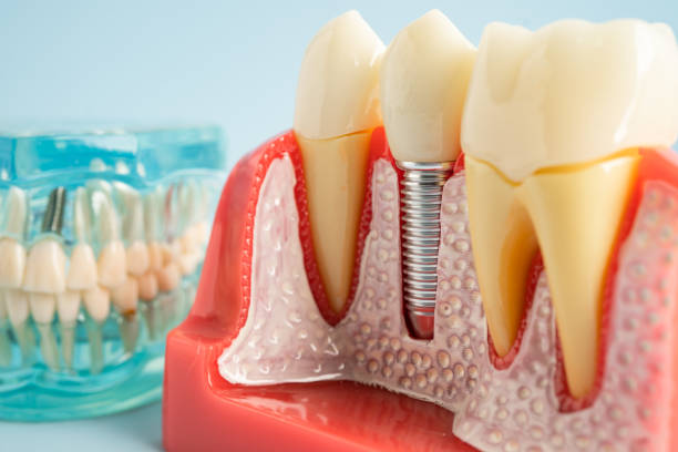 Our Range of Dental Services in Sumner, WA